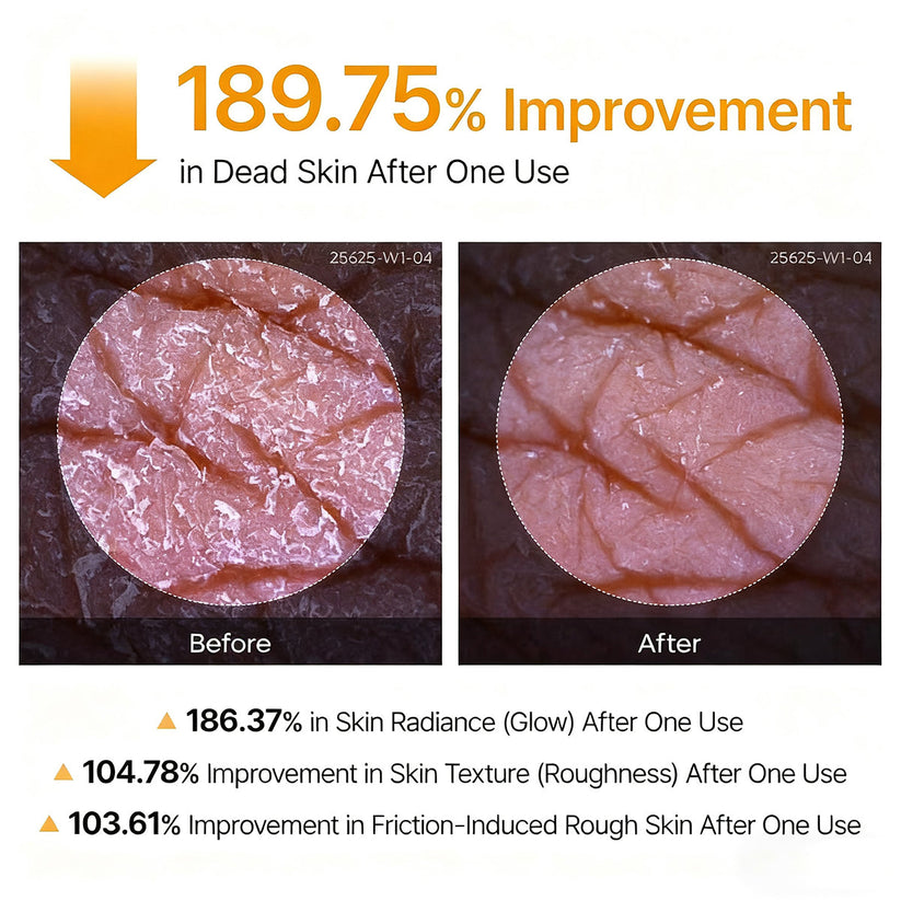 Bavilory Peel Shot - Kojic + Turmeric Body Peel Spray