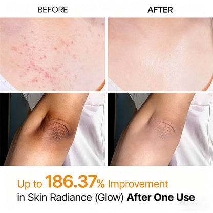 Bavilory Peel Shot - Kojic + Turmeric Body Peel Spray