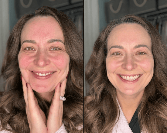 derma_before_after_1.png