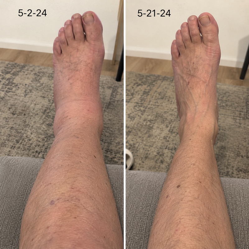 using Bavilory less than 8 weeks