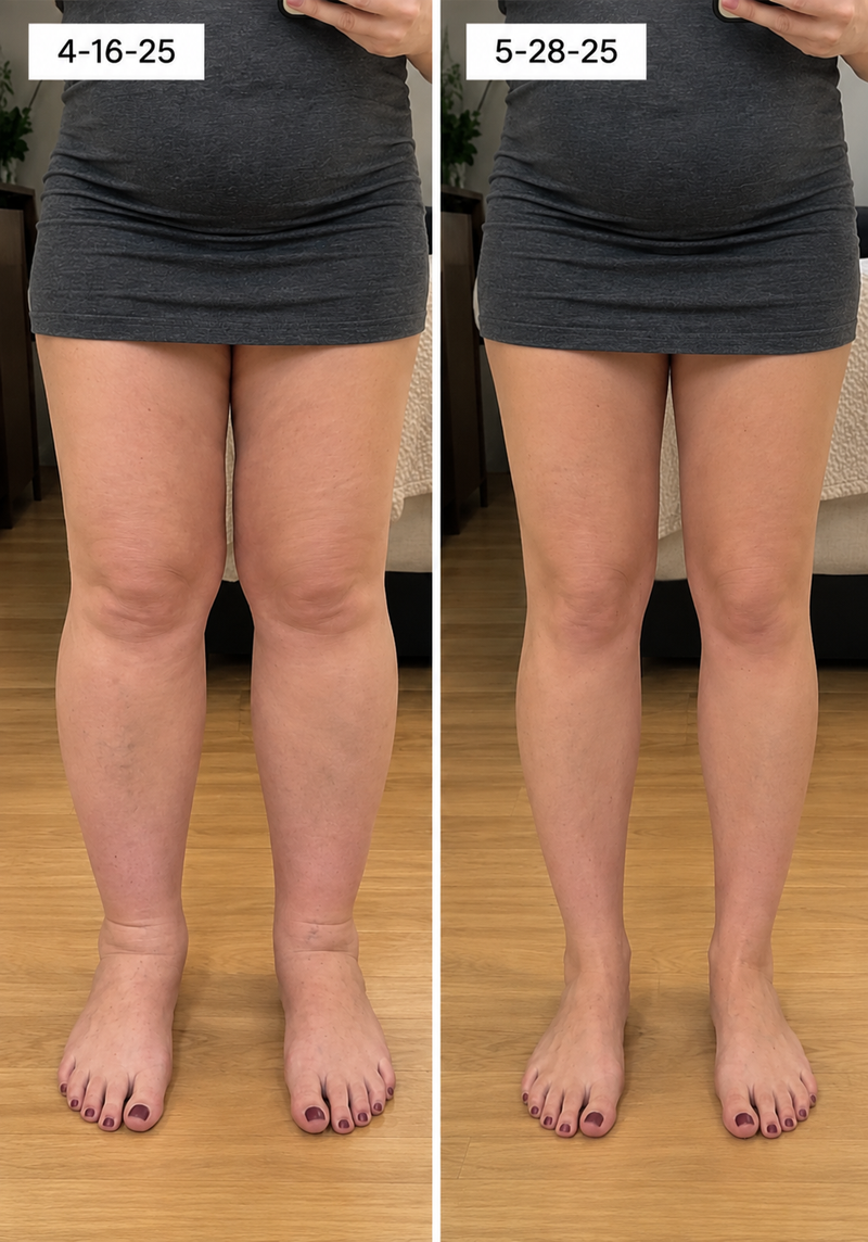 using Bavilory less than 8 weeks
