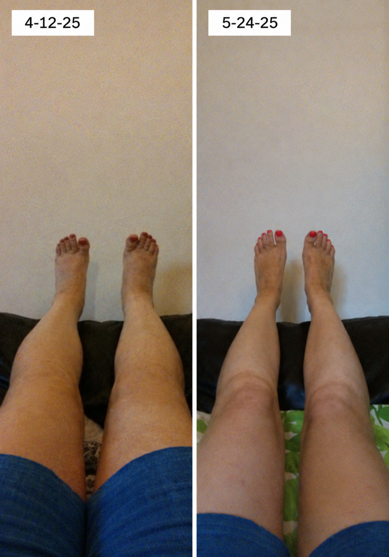 using Bavilory less than 8 weeks