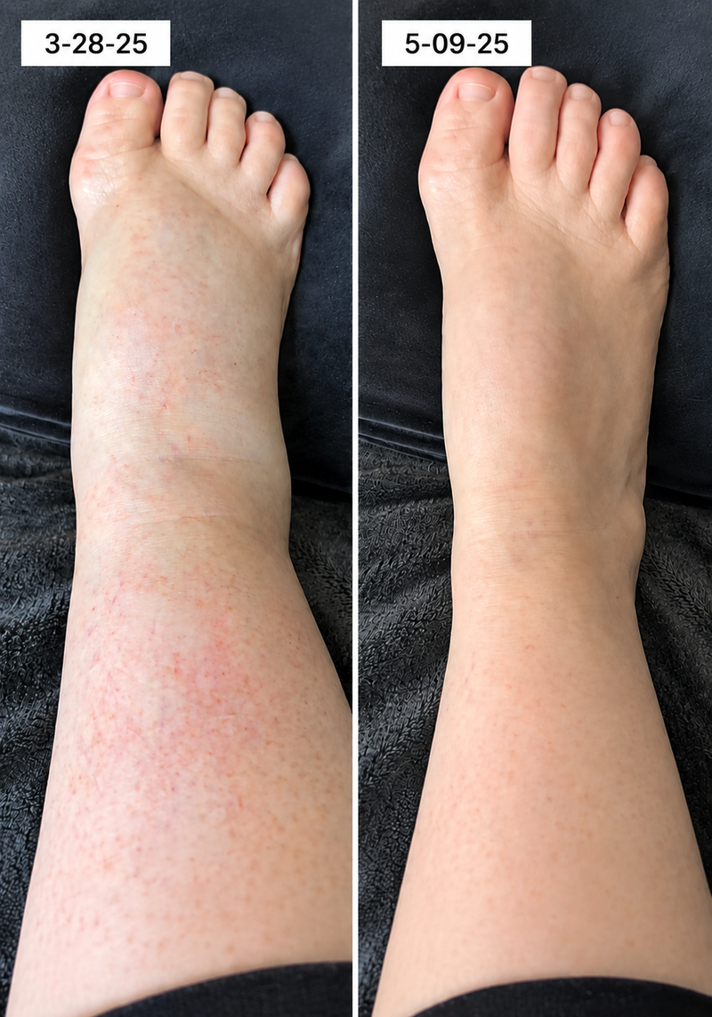 using Bavilory less than 8 weeks